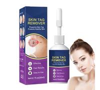 Wart Remover,Skin Tag Remover Cream for Hands and Body,Tags and Mole Remover Cream for Body,Fast Acting Liquid Treatment,Wipe Off Tags and Mole,Moisturize,Face and Body Skin Care,Make The Skin Smooth
