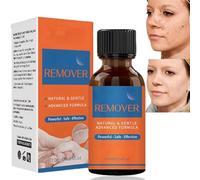 Warts & Mole Remover Cream,Natural Skin Tag Remover,Skin Tag Remover for Face & Hands & Body,Natural Formula,Skin Tag Remover Liquid,Tags and Mole Remover,Fast-Acting & Effective Skin Tag Remover