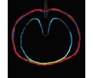 Wasp Star (Apple Venus, Pt. 2) by XTC (Record, 2018)