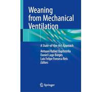 Weaning from Mechanical Ventilation: A State-of-the-Art Approach