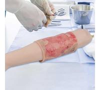 Wearable Burn Wound Training Model, 2-3 Degree Limbs, Realistic Simulated Burn Injury Pad for Medical Practice and Teaching Demonstrations