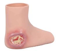 Wearable Heel Ulcer Wound Training Sleeve, Realistic Silicone Foot Model, Reusable Wound Care Practice Kit, for Decubitus Ulcer Care Practice Demonstration and Teaching Practice