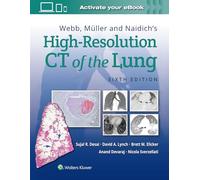 Webb, Müller and Naidich's High-Resolution CT of the Lung