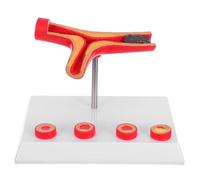 WEKADRIN Human Cardiovascular Model Vascular Blockage Simulation Medical Teaching Tool for Clinical Pathology Study Anatomical Blood Vessel Model for Enhanced Learning