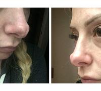 Welcome To Jurassic Schnoz