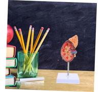 WHAMVOX Anatomy Teaching Tool for Medical Study Biology Class Prop Kidney Dissection and Patient Education