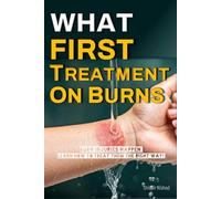 What First Treatment on Burns?: Essential First Aid for Burns