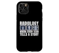 Where every Scan tells a Story Radiology Case for iPhone 11 Pro