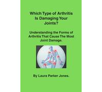 Which Type of Arthritis Is Damaging Your Joints?: Understanding the Forms of Arthritis That Cause the Most Joint Damage. (How to live with arthritis)
