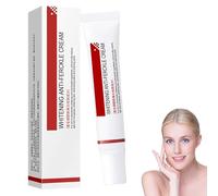 Whitening and Anti-Freckle Removal Moisturizing Cream, Whitening Freckle Cream, Dark Spot Remover for Face, Hyperpigmentation Treatment, Brightening & Moisturizing for Women and Men (1)