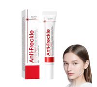 Whitening Freckle Cream, Whitening Cream, Pigment Spot Remover Face, Anti Freckle, Whitening Cream Against Dark Spots, Remove Age Spots, Anti-Wrinkle Freckles