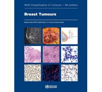 WHO Classification of Breast Tumours: WHO Classification of Tumours, Volume 2 (World Health Organization Classification of Tumours)