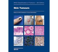 WHO Classification of Skin Tumours 5th edition: Who Classification of Tumours