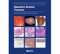 WHO Classification of Tumours. Digestive System Tumours: WHO Classification of Tumours, Volume 1 (World Health Organization Classification of Tumours)