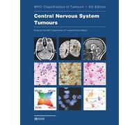 WHO classification of tumours of the central nervous system: 6 (World Health Organization classification of tumours)