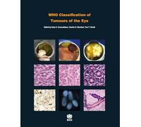 WHO Classification of Tumours of the Eye: WHO Classification of Tumours, Volume 12: Vol. 12 (World Health Organization classification of tumours)