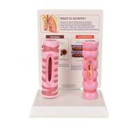 WHOOLEFUN Human Healthy Trachea And Pathological Comparison Model, Respiratory Anatomy Model, with English Instruction Card, for Medical Education, Physiology Study, Classroom Teaching