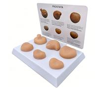 WHOOLEFUN Prostate Model Set with Pathologies, Prostate Palpation Anatomy Model, Male Reproductive System Lesion Training Tool, with Annotation Card, for Study Display
