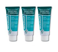 AKILEÏNE AKILWINTER Cream Against Chilblains and Frostbites - 75ml