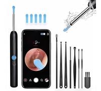 Wireless Ear Wax Removal Kit with AI Detection, 1920P HD Otoscope Camera, Visual Ear Cleaner with 6 Soft Silicone Tips for Adults & Kids, Type-C Fast Charging, Safe for Family Use