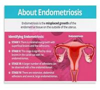 Womens Body Awareness Educational Guide Canvas Wall Art for Gynecology Office or Library(Framed,16x24inch(40x60cm))