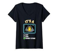 Womens It's A Kidney Stone Gender Reveal Graphic V-Neck T-Shirt