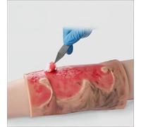 Wound Care Model，Burn Wound Simulator Silicone Moulage Kit for Medical Training Realistic 2nd & 3rd Degree Burn Model for First Aid Nursing Skill Practice-Model