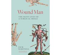 Wound Man: The Many Lives of a Surgical Image