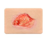Wound Packing Trainer, Unhealthy Granulation Wound Simulation Models for Medical Education, Wound Care Demonstrations Tool