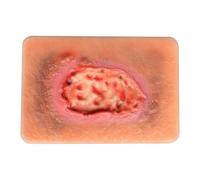 Wound Packing Trainer, Wet Necrotic Wound Simulation Models for Medical Education, Wound Care Demonstrations Tool