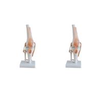 Wouueso 2X Knee Joint Simulation Model Anatomy Human 1:1 Life Size