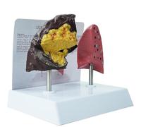 Wsexyy Smoking Lung Anatomy Model, Life-Size Human Lung Anatomy Models, Smoker's Lung Healthy Lung Comparison Model, PVC Structure, for Demonstrating Smoking Effects, for Medical Study Display