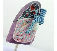 WXKAGF Human Model, Anatomical Model of The Human Lung Pathological Tuberculosis Breath Model Pneumonia of The r Thoracic Surgery for Doctor Patient Training Office