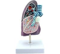 WXKAGF Human Model, Anatomy Model Anatomical Model of Human Lung Pathological Pneumonia Tuberculosis Cigarette Thoracic Surgery Breathing Model