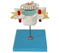 WXKAGF Human Model, Body Model Cervical Spinal Cord and Spinal Nerve Enlargement Model Human Organ Anatomy Model Medical Anatomical for Science Study Display Teaching Medical Model