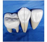 WXKAGF Human Model, Tooth Model Implant Teeth Anatomy Model Study Teach Standard Model Human Anatomical Model