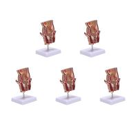 Wzxksoac 5X Anatomy Model Human Rectal Lesion Model Fistula Fistula Fissure Pathology Teaching Model