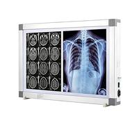 X-Ray Led Film Viewer Wall Mounting Illuminatorss Light Box Aluminum Frame and Acrylic Panel Adjustable Brightness X-Ray Viewbox for Hospitals and Clinics