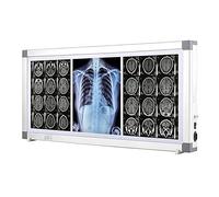 X-Ray Led Film Viewer Wall Mounting Illuminatorss Light Box Aluminum Frame and Acrylic Panel Adjustable Brightness X-Ray Viewbox for Hospitals and Clinics