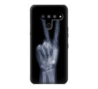 X-ray Peace Sign Fingers Case Cover For LG V50, LG V50 ThinQ 5G