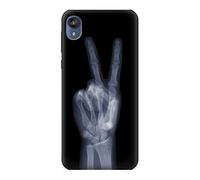 X-ray Peace Sign Fingers Case Cover For Motorola Moto E6, Moto E (6th Gen)