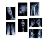 X-ray science education pack for human anatomy and bone parts is suitable for light table and lamp fixtures.