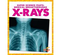 X-Rays (Super Science Feats: Medical Breakthroughs)