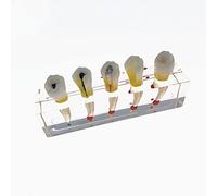 XDAWQP Dental Teaching Demonstration Model, Detachable Pulp Body Decomposition Model, Pulp and Root Canal Treatment Model, Doctor-Patient Communication Model, Teaching Model