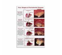 XGINERFEX Pet Health Poster Dog Periodontal Disease Stages Guide Anatomical Chart for Veterinary School Office Decor(Framed,12x18inch(30x45cm))