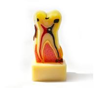Xiaoxu Dental Caries Model Tooth Decay Tooth Anatomy Model,Dental Problems Oral Comprehensive Teeth for School Teaching Research