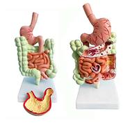 Xiaoxu Model of Human Gastrointestinal Anatomy,Model of The Human Digestive System, Colon Disease Model, Structure of The Internal Organs for Teaching in Medical Displays