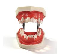 Xiaoxu Orthodontic Teaching Model, Orthodontics Malocclusion Teeth Typodont Demonstration,Teeth Anatomy Education Model,Red Wax Gum Teeth Practice Model for Teaching Study