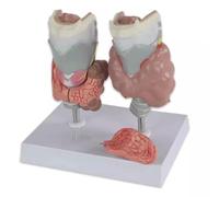 Xiaoxu Thyroid Anatomy Model for Medical Education, Endocrine Organ Model for Disease Demonstration, Anatomical Learning Tool, Educational Health Resource