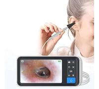 XINGLUOY Digital Otoscope, 3.9mm Visual Ear Scope, 4.5 Inch Screen and 6 LED Lights, 2500mAh Rechargeable Battery, for Adults, Children And Pets